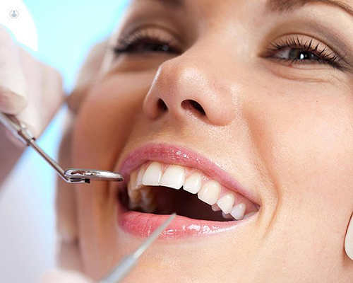 Embracing Holistic Dentistry in Tampa: A Comprehensive Guide