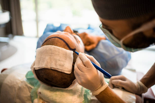 From Consultation to Transformation Journey: Hair Transplant in Riyadh
