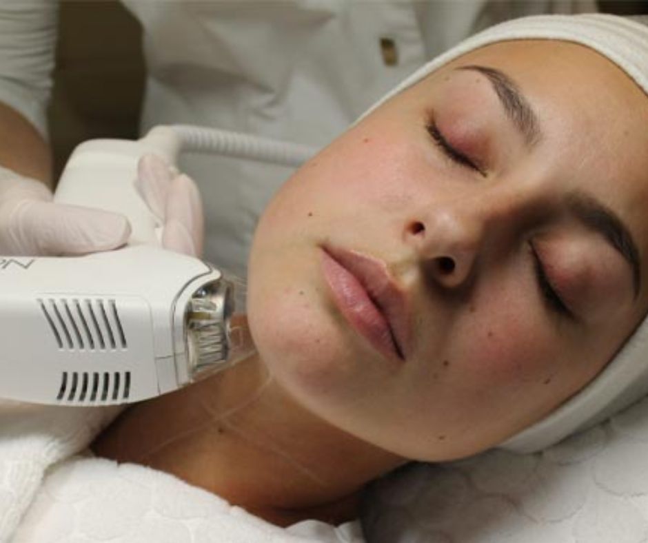 Why Tixel Treatment is the Future of Skin Rejuvenation