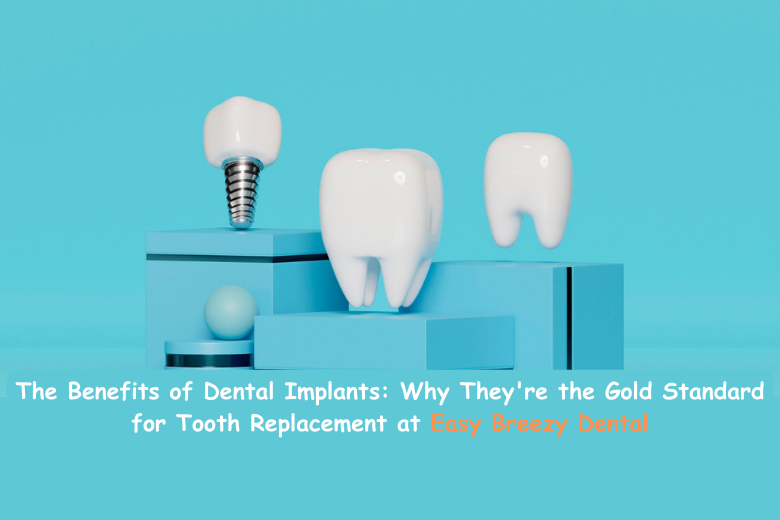 The Benefits of Dental Implants: Why They’re the Gold Standard for Tooth Replacement at Easy Breezy Dental