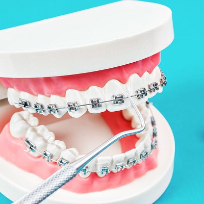 Advanced Orthodontic Solutions from Dubai's Specialists