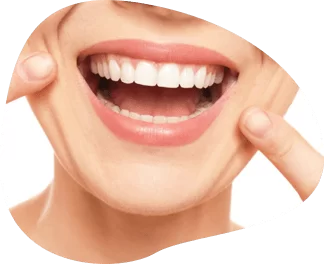 Teeth Whitening Aberdeen