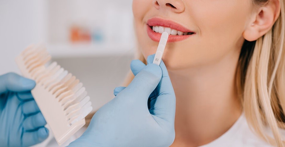 Teeth Whitening Dentist in Hornsby: A Comprehensive Guide by White Cross Dental 