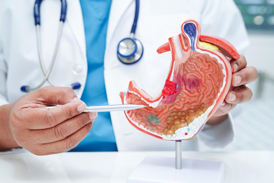 The Importance of Regular Check-Ups with a Digestive Care Doctor in Dubai